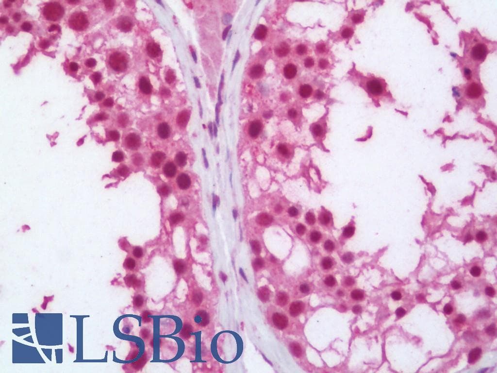 IHC-plus™ Polyclonal Rabbit anti-Human TRIP12 Antibody (aa75-125, IHC, WB)