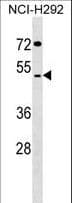Polyclonal Rabbit anti-Human SUDS3 Antibody (aa72-98, WB)