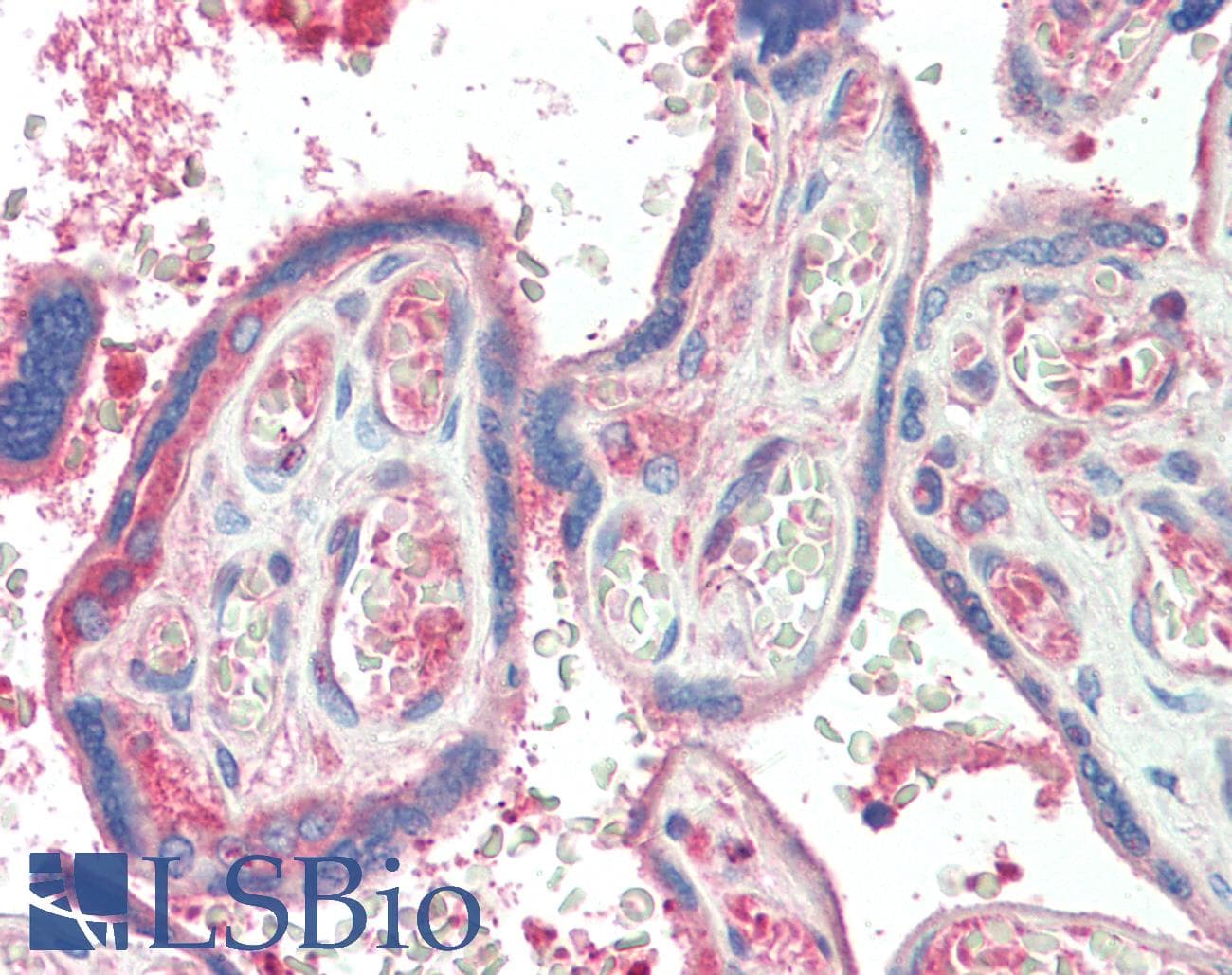 IHC-plus™ TXK / RLK Antibody (aa515-527)