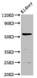 Polyclonal Rabbit anti-Human PIGW Antibody (WB)