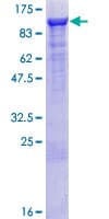 Human ARHGAP26 / GRAF Protein (Recombinant GST)