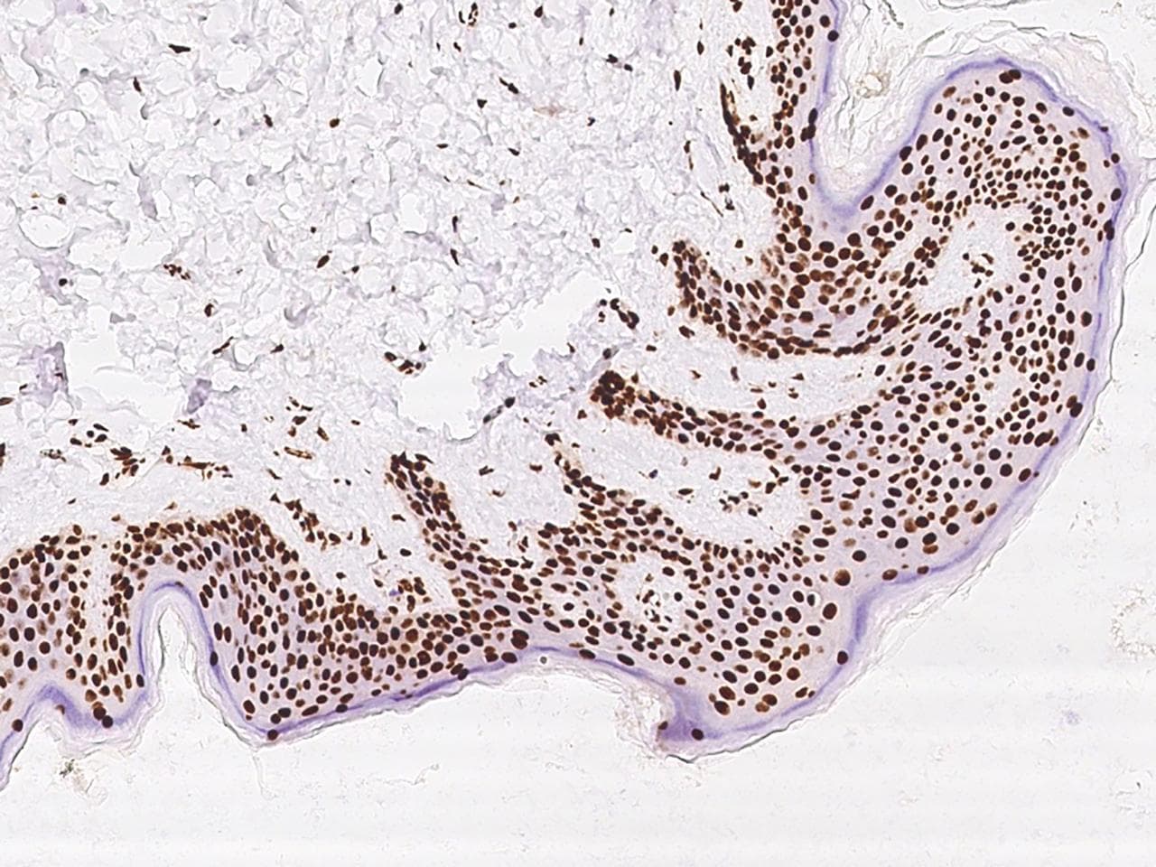 SARNP / Hcc-1 / CIP29 Antibody