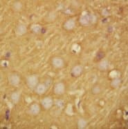 SNAP25 Antibody (C-Terminus, Magnetic beads)