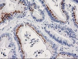 FGFR2 / FGF Receptor 2 Antibody (clone OTI1H5)