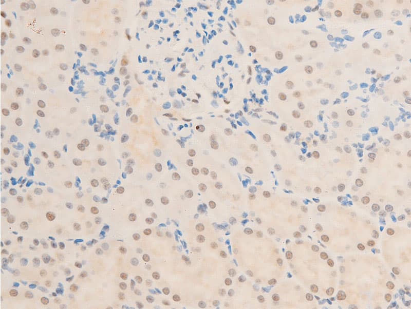 Polyclonal Rabbit anti-Human TK1 / TK / Thymidine Kinase Antibody (phospho-Ser13, IHC, IF, WB)