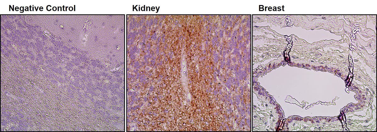 BMPR2 Antibody (clone 3F6F8)