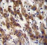 PHF20 Antibody (aa123-151)