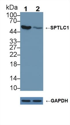 Polyclonal Rabbit anti-Mouse SPTLC1 / HSN1 Antibody (aa143-473, WB)