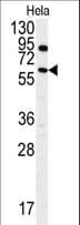 ANTXR1 / TEM8 Antibody (Tyr382)