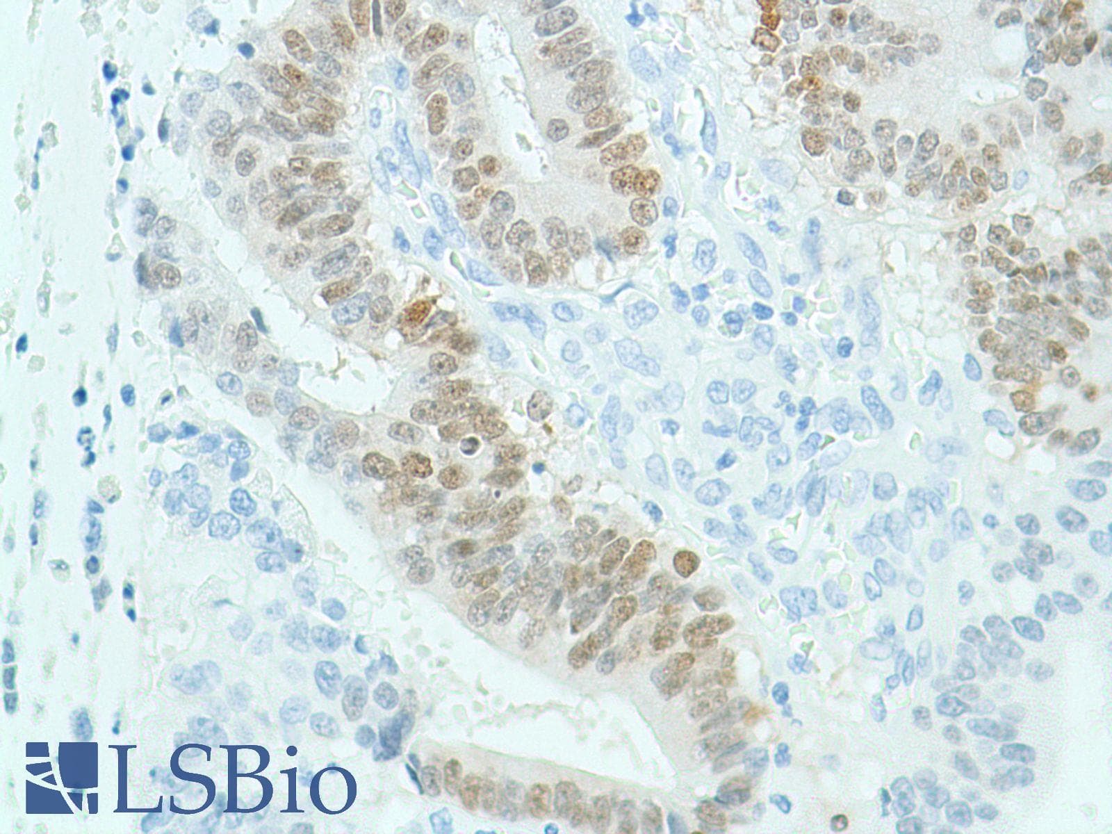 SOX2 Antibody (N-Terminus, clone SP76)