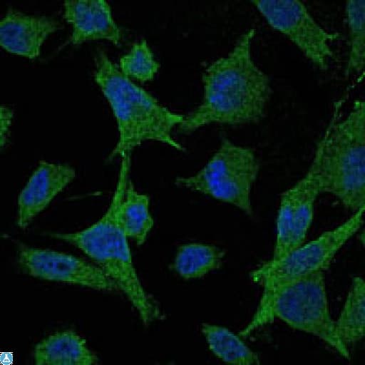 MAP2K6 / MEK6 / MKK6 Antibody