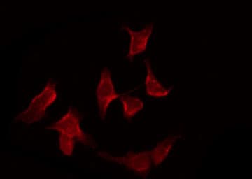 Polyclonal Rabbit anti-Human APAF1 / APAF-1 Antibody (IHC, IF, WB)