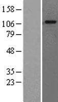 GAA / Alpha-Glucosidase, Acid Protein (Over-Expression Lysate Myc-DDK (Flag))