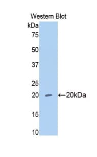 MMP13 Antibody (aa62-217)