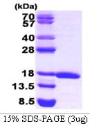 Human EIF5A Protein (Recombinant)