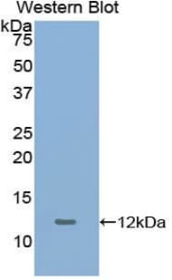 GYPA / CD235a / Glycophorin A Antibody (aa20-91, FITC)