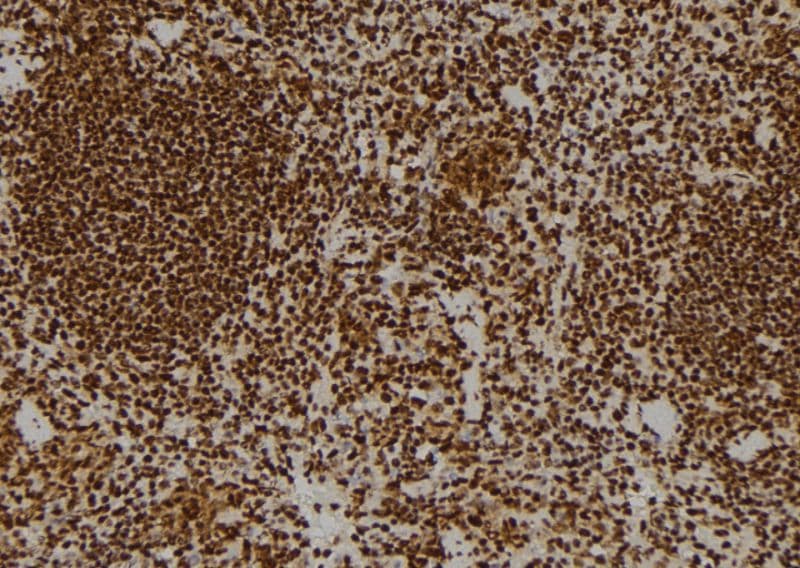 PR / Progesterone Receptor Antibody