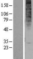 Human GPR1 Protein (Over-Expression Lysate Myc-DDK (Flag))