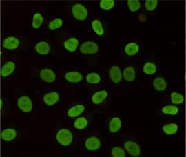 PathPlus™ Monoclonal Mouse anti-Human CBX3 / HP1 Gamma Antibody (IHC, WB)