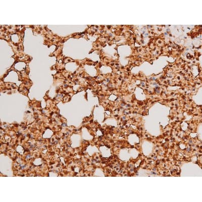 Polyclonal Rabbit anti-Human SYK Antibody (phospho-Tyr348, IHC, IF, WB)