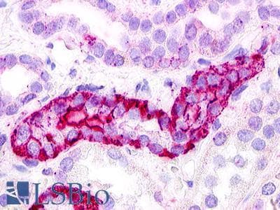 PathPlus™ GPRC5D Antibody (Extracellular Domain)