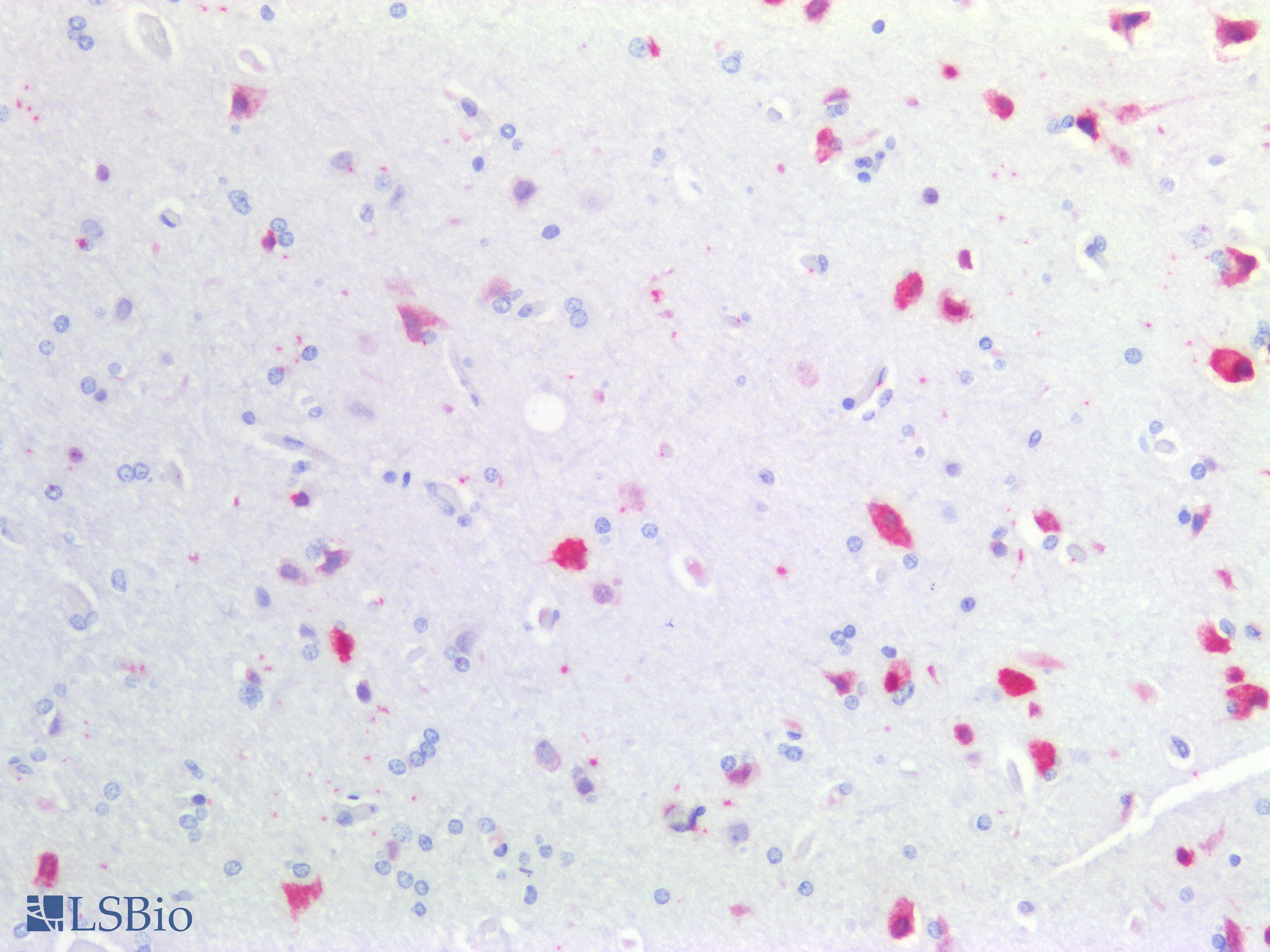PathPlus™ ELAVL2 / HUB Antibody