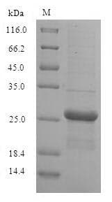 Human GUK1 / Guanylate Kinase 1 Protein (Recombinant 6His-SUMO, N-terminus)