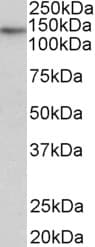 Polyclonal Goat anti-Human TERT / Telomerase Antibody (aa597-611, WB)