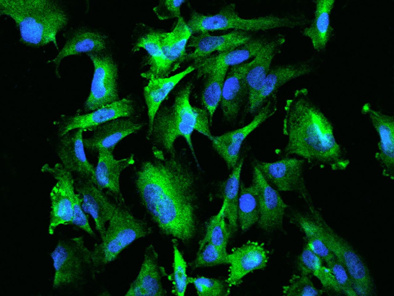 PUM1 Antibody