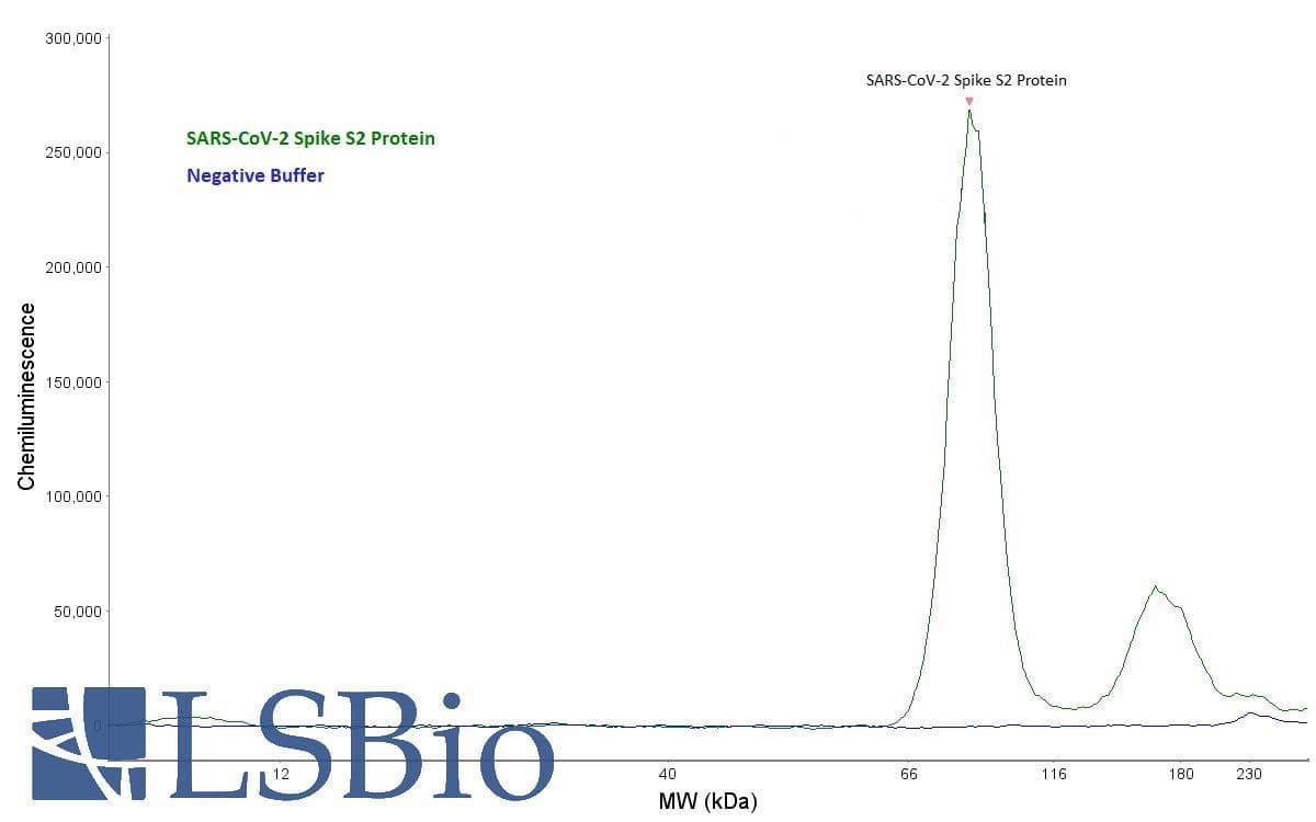SARS-CoV-2 Spike Glycoprotein Antibody