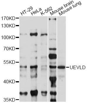 UEVLD Antibody