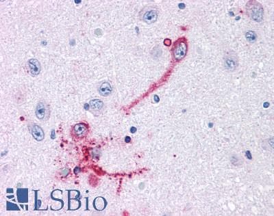 PathPlus™ GPR108 Antibody (Cytoplasmic Domain)