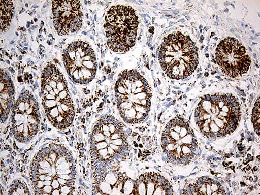 Monoclonal Mouse anti-Human MCAD / ACADM Antibody (clone OTI9G10, IHC, WB)