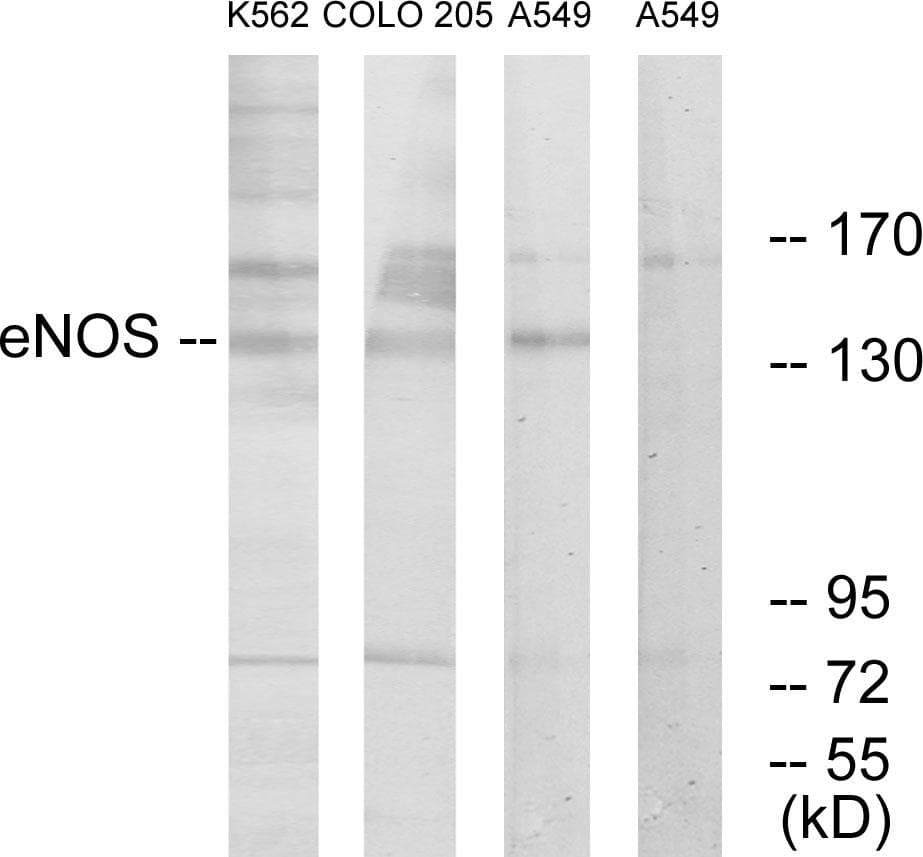 NOS3 / eNOS Antibody (p1179)