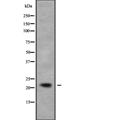 Polyclonal Rabbit anti-Human NCALD / Neurocalcin Delta Antibody (WB)