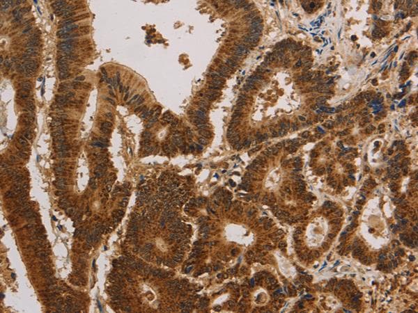 CSNK2B / Phosvitin Antibody
