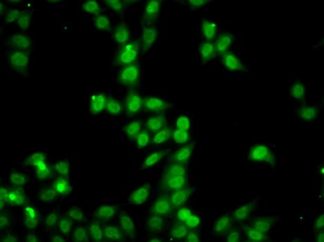 Polyclonal Rabbit anti-Human HDGFRP2 Antibody (IHC, IF, WB)