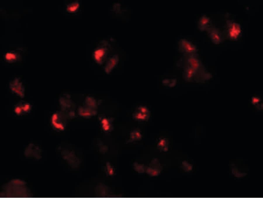 LY9 / CD229 Antibody