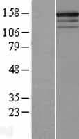 Human RPGRIP1 Protein (Over-Expression Lysate Myc-DDK (Flag))