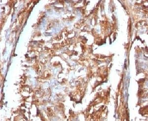 B2M / Beta 2 Microglobulin Antibody (clone B2M/961, Ready-to-Use)