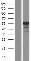PFKFB2 Protein (Over-Expression Lysate Myc-DDK (Flag))