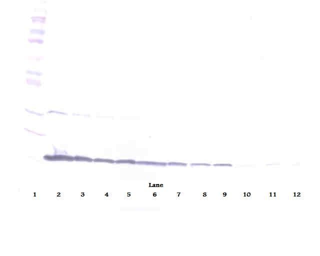 IHC-plus™ Polyclonal Goat anti-Human CD40L Antibody (IHC, WB)