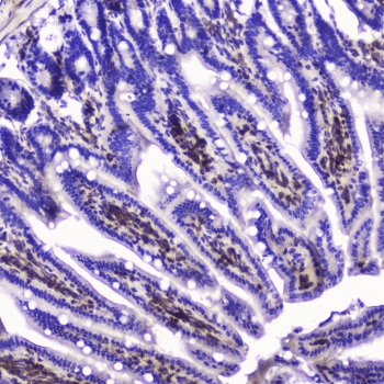 TLN1 / Talin 1 Antibody