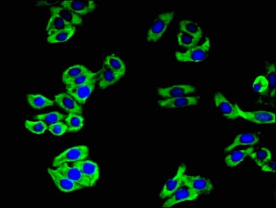 CAMLG / CAML Antibody
