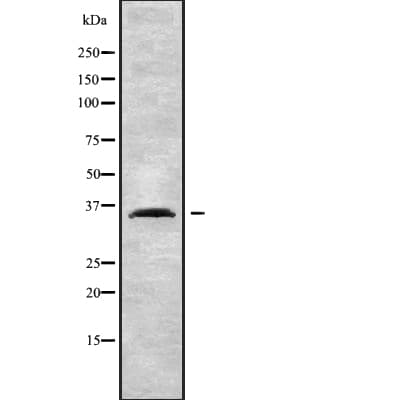 HOXD13 Antibody