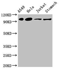 IREB2 / IRP2 Antibody