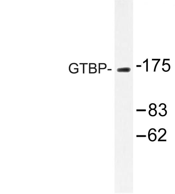 MSH6 Antibody (Glu371)