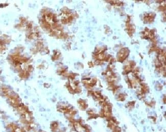 TNF Alpha Antibody (clone TNFA/1172)