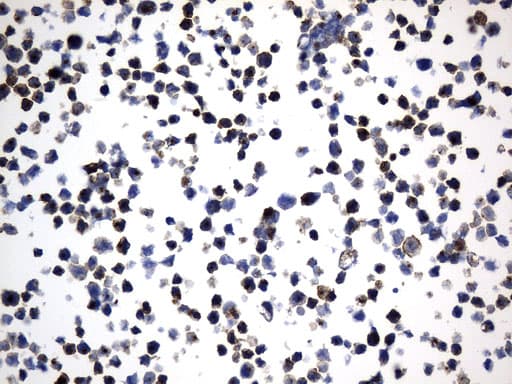 MME / CD10 Antibody (aa411-750, clone UMAB236)