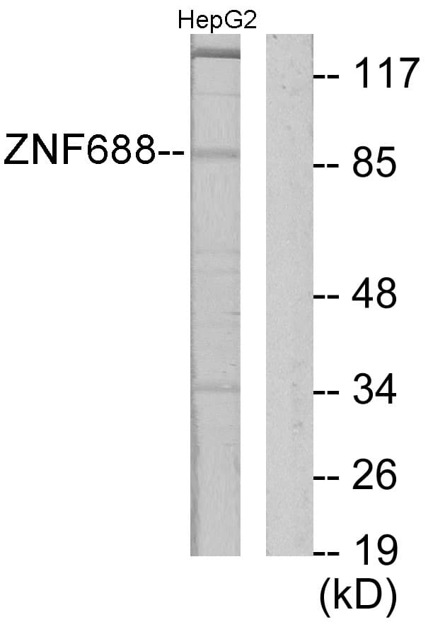 Polyclonal Rabbit anti-Human ZNF785 Antibody (aa91-140, WB)